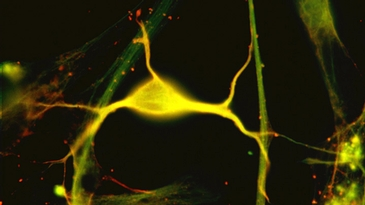 microscopic image of a neuron, what is a neuron, neuron diagram